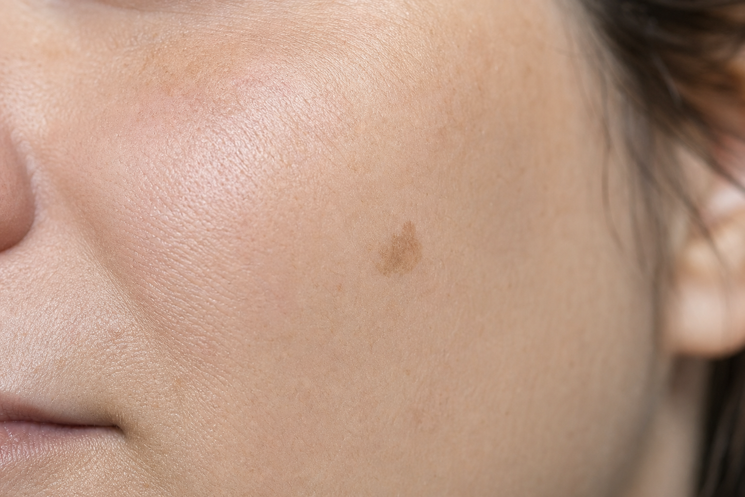 carcinome-visage-photo-signes-visuels.png